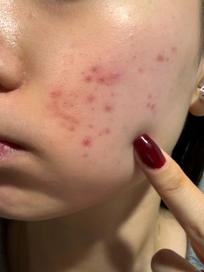 没换了？这种毛巾建议马上换掉开元棋牌app你家的毛巾多久(图4)